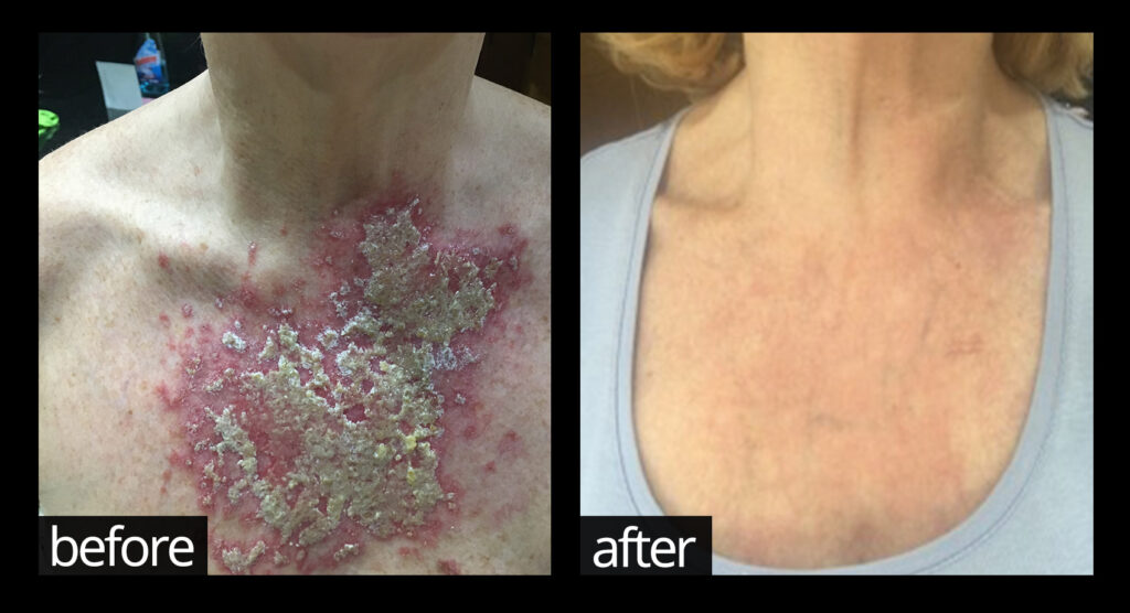 Before and Afters... | Chuckling Goat