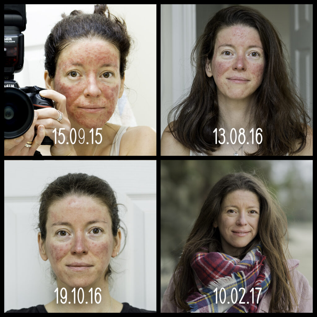 Before and Afters... | Chuckling Goat