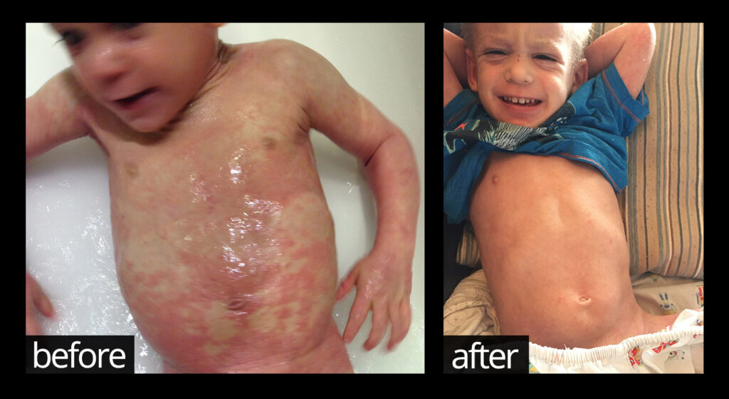 Before and Afters... | Chuckling Goat