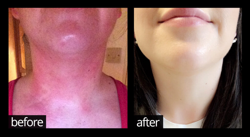 Before and Afters... | Chuckling Goat