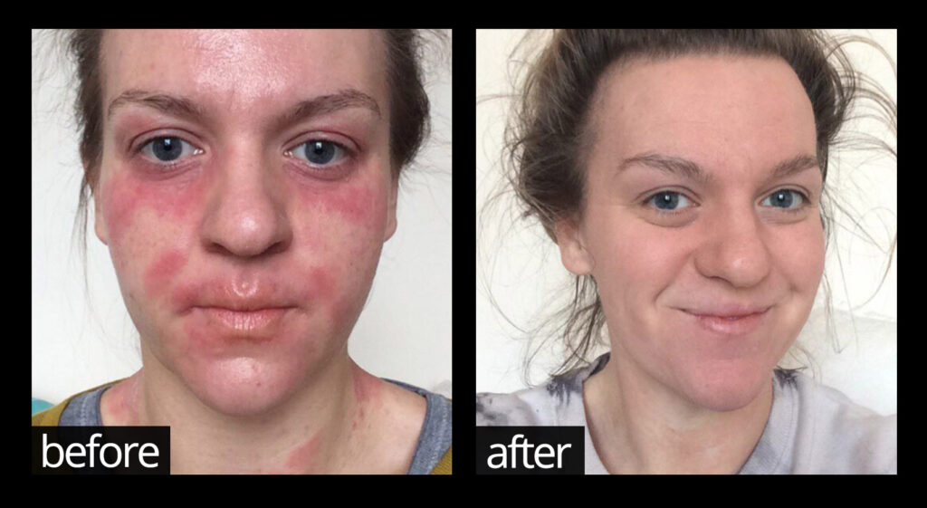 Before and Afters... | Chuckling Goat