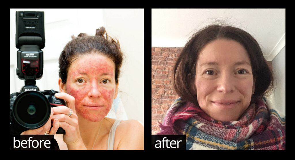 Before & After | Chuckling Goat