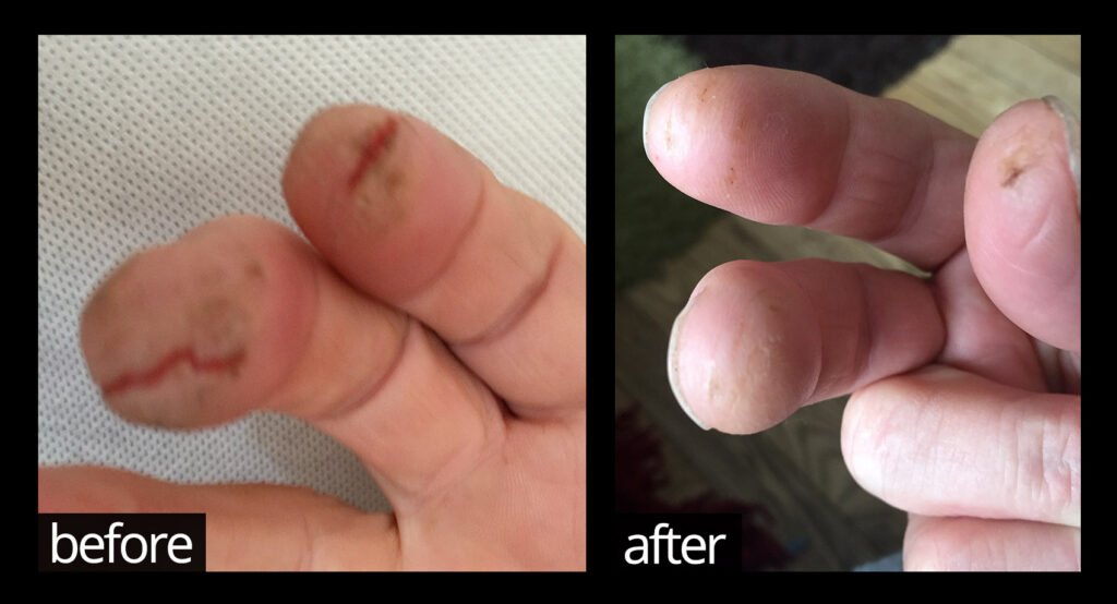 Before & After | Chuckling Goat