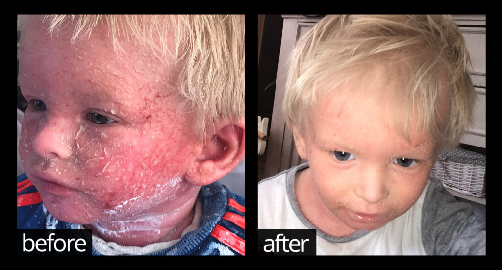 Before & After | Chuckling Goat