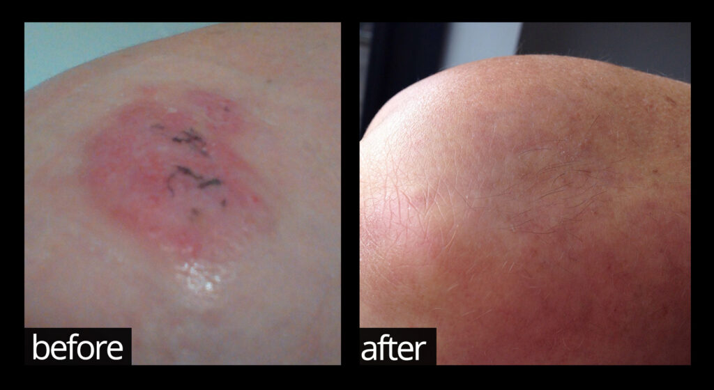 Before & After | Chuckling Goat